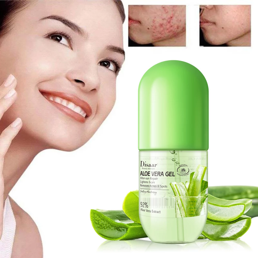 Aloe vera sirve para los granos