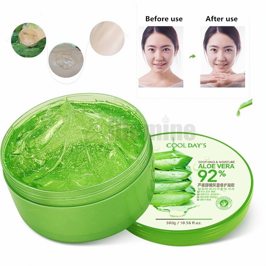 Aloe vera para quemaduras en la cara