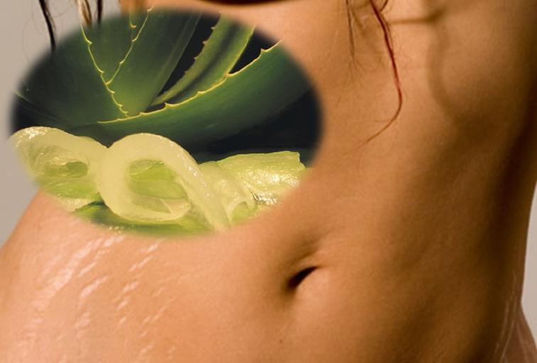 Como quitar las estrias rojas con aloe vera
