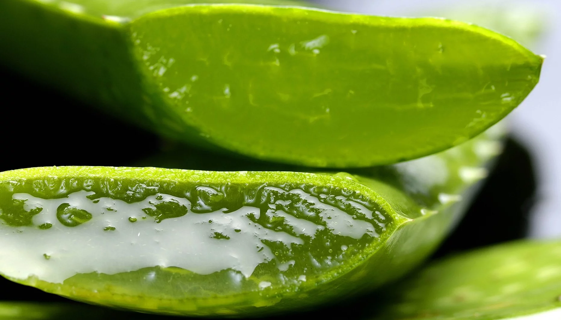 Como curar quemaduras con aloe vera