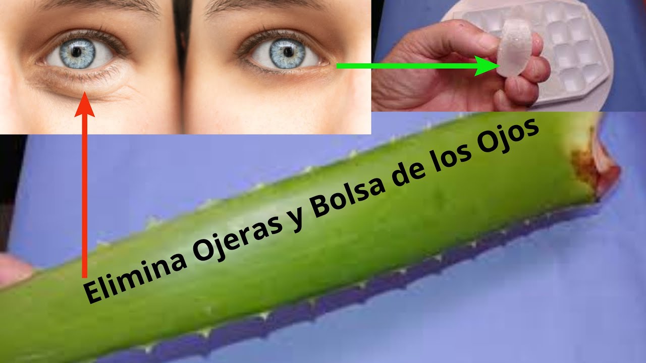 Aloe vera bolsas debajo ojos