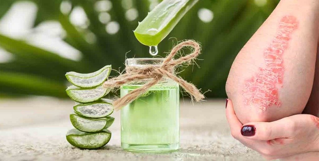 Aloe vera para inflamacion