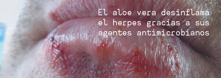 Aloe vera para la lengua