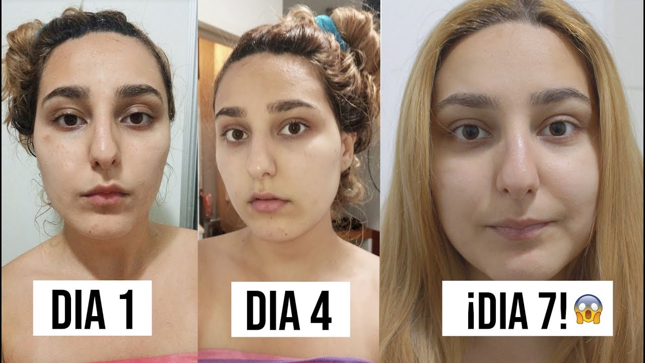 Como echarse aloe vera en la cara