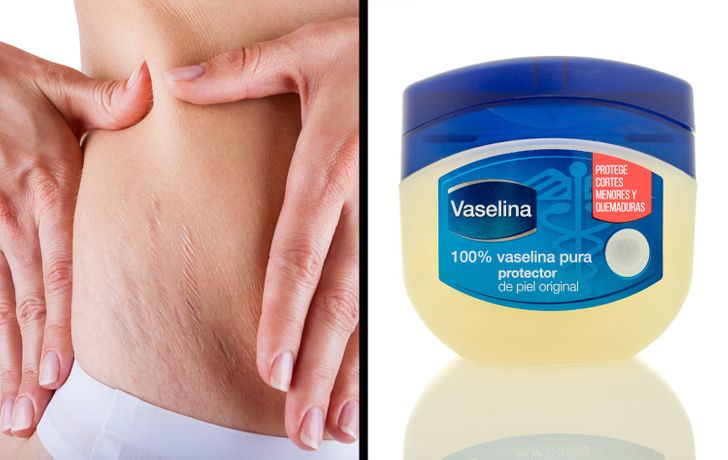 Crema casera de aloe vera para cicatrices