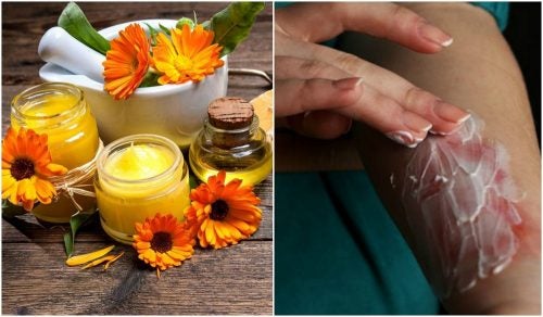 Crema de matico con aloe vera y calendula