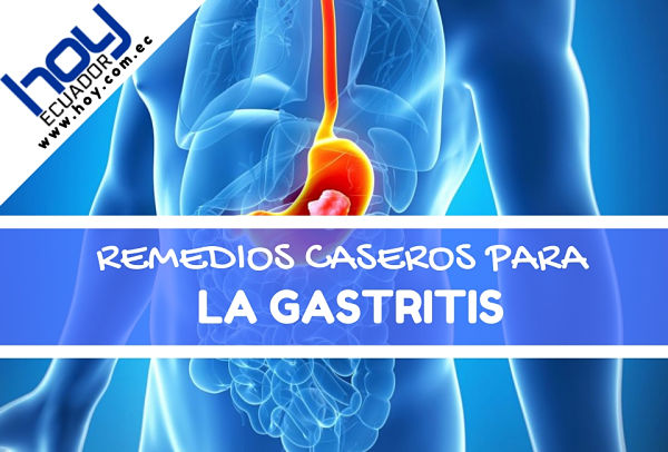 Remedio de aloe vera para la gastritis