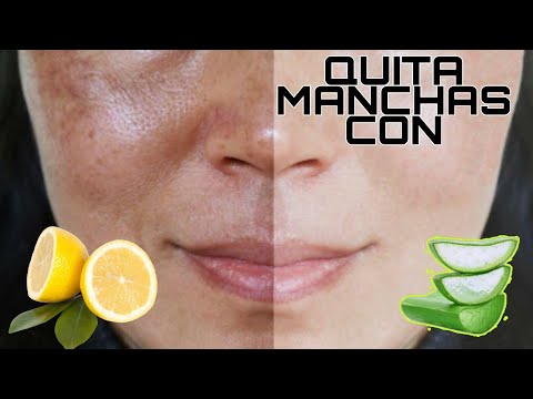 Mascarilla de aloe vera y limon para las manchas