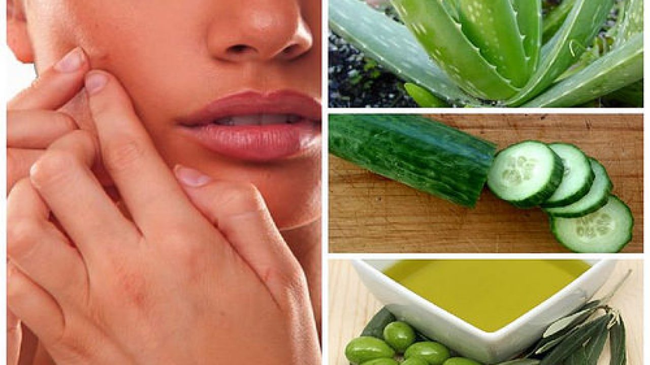 La aloe vera es buena para los granos