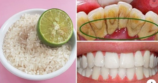 Aloe vera blanquea dientes