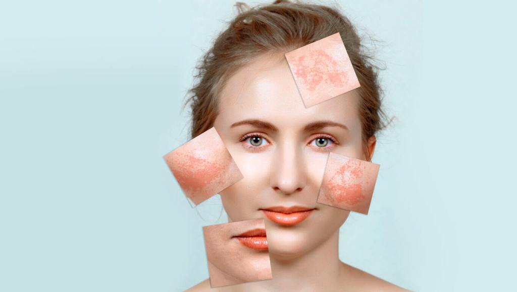 El aloe vera sirve para quitar las manchas dela cara