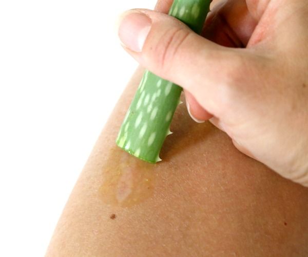 Aloe vera para erupciones cutaneas