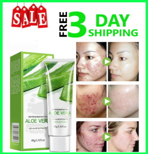 Crema aloe vera para manchas cara