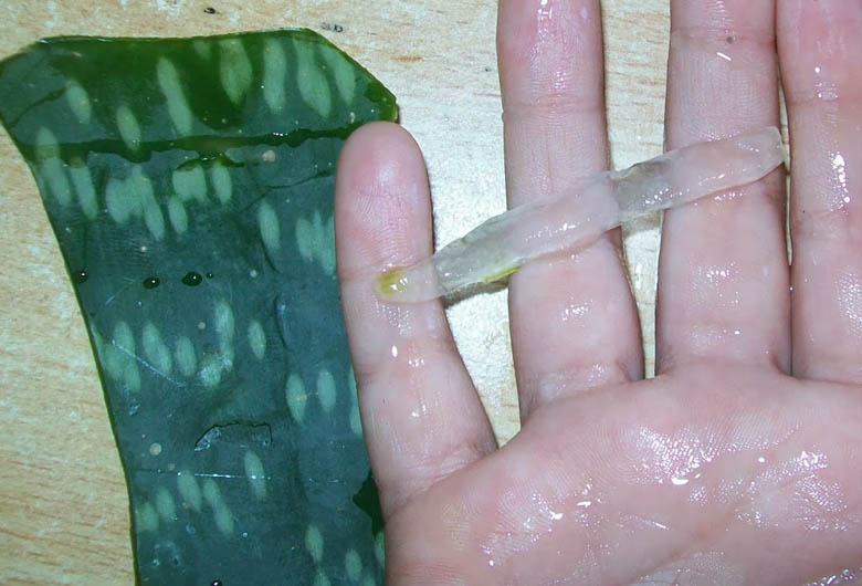 Aloe vera para hemorroides trombosadas