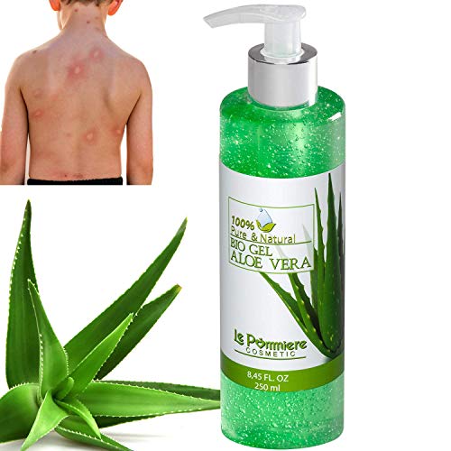 Cómo aplicar aloe vera en una quemadura