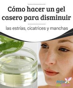 Como hacer crema de aloe vera para cicatrices