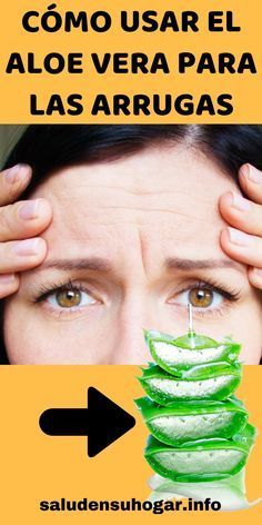 Aloe vera sirve para las ojeras