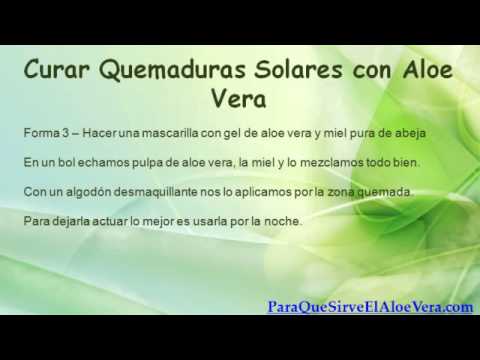 Cómo usar aloe vera para quemaduras de sol