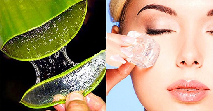 Se puede congelar el gel de aloe vera