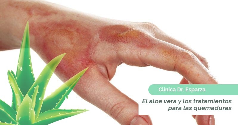 Quemaduras asfalto aloe vera