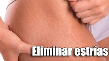 Eliminar estrias blancas con aloe vera