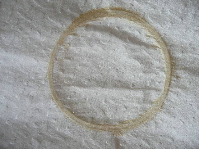Como quitar manchas de aloe vera de la ropa