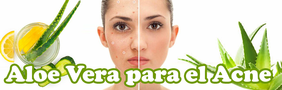Cubitos de aloe vera para el acne
