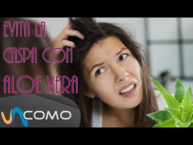 Como quitar la caspa con aloe vera