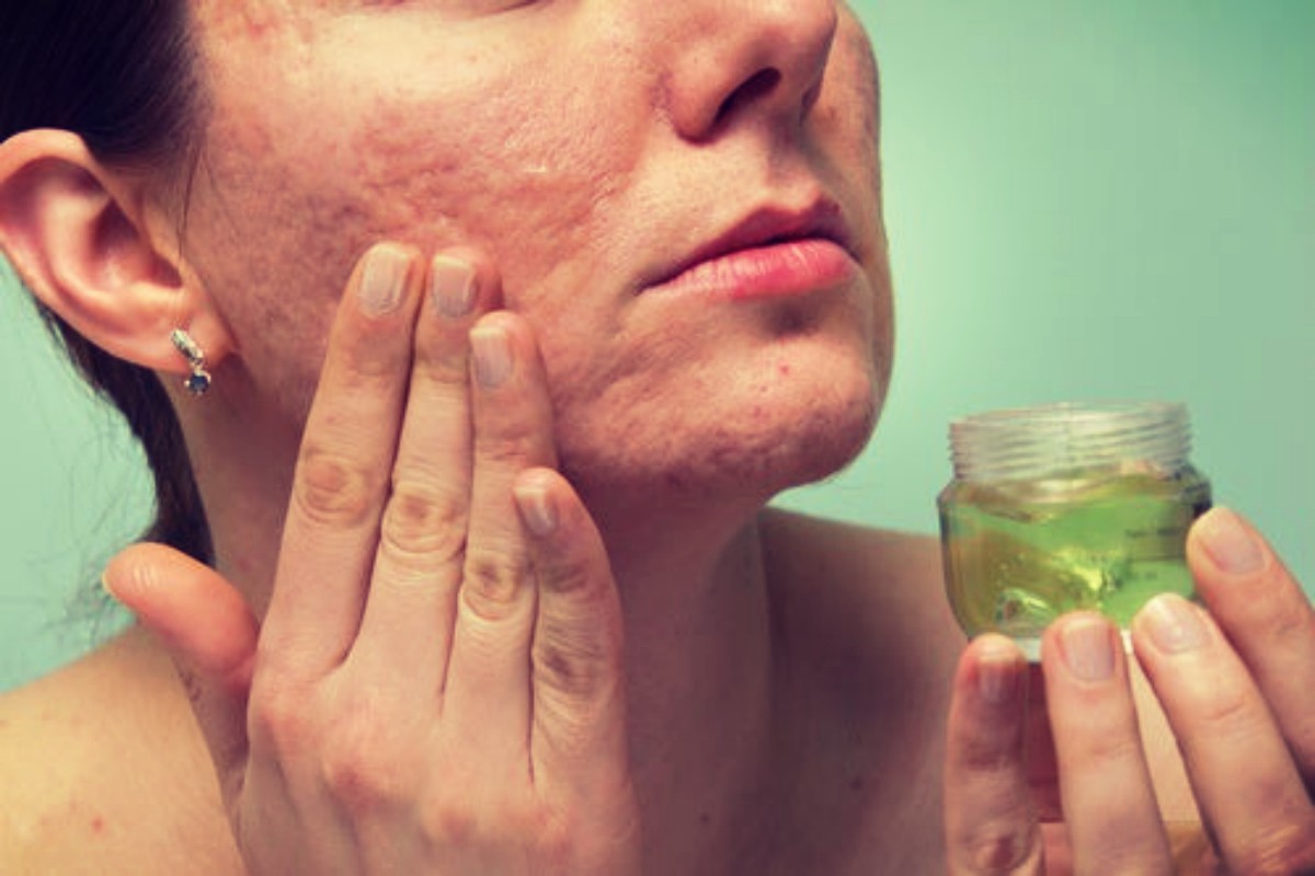 Como preparar gel de aloe vera para el rostro